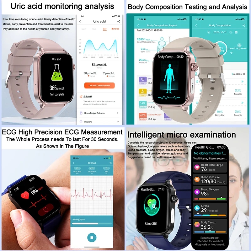 2025 New For XIAOM1 ECG+PPG Bl – Smart Home Energy Management Bewertung und Preis